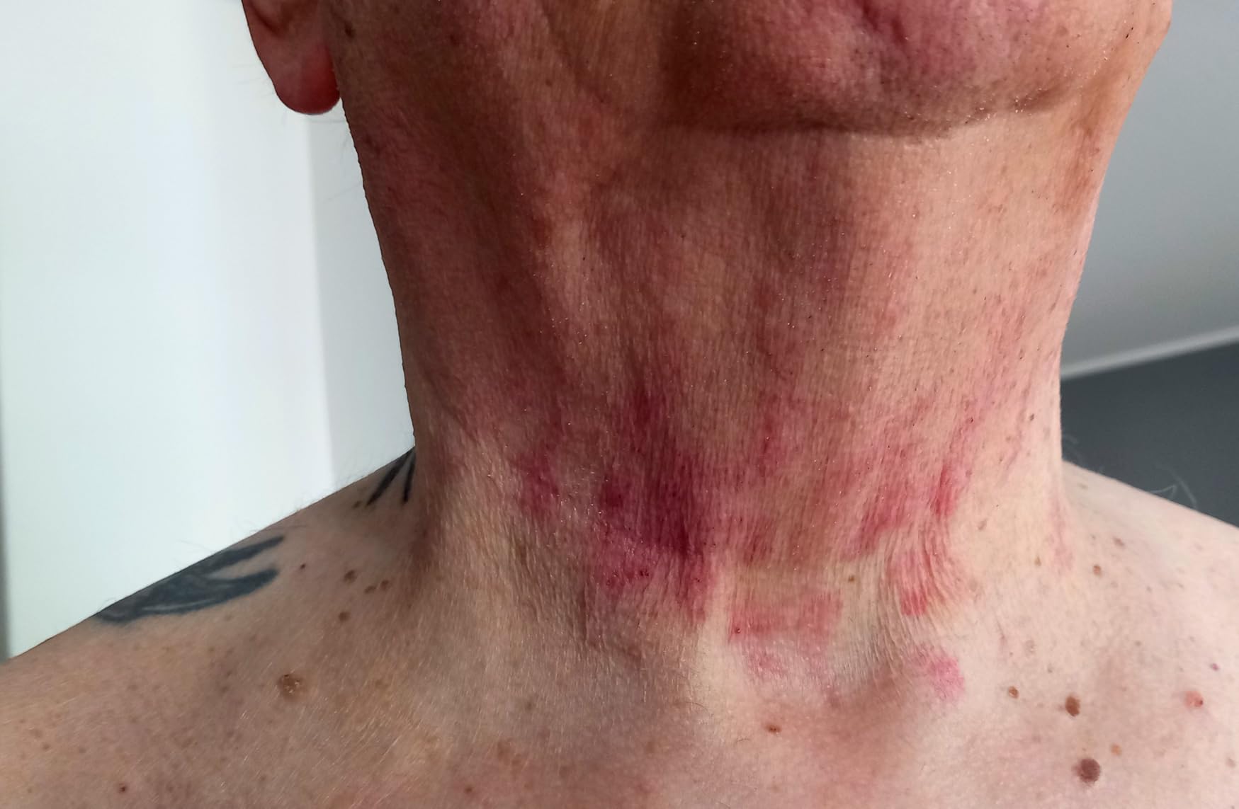 Non per barbe foltissime